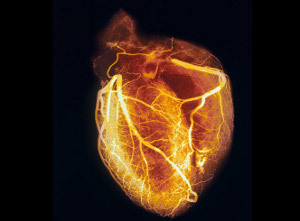 How a Nuclear Heart Scan Works