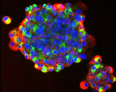 Stem cells used